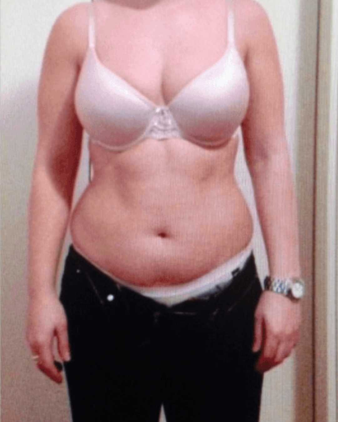 Antes